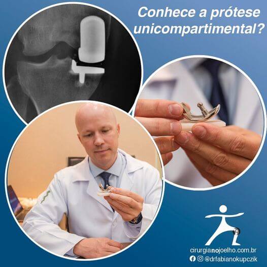 Conhece A Protese Unicompartimental