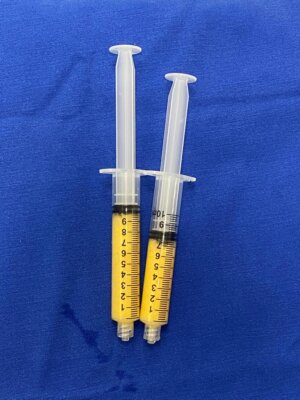 Lipogems para infiltração articular