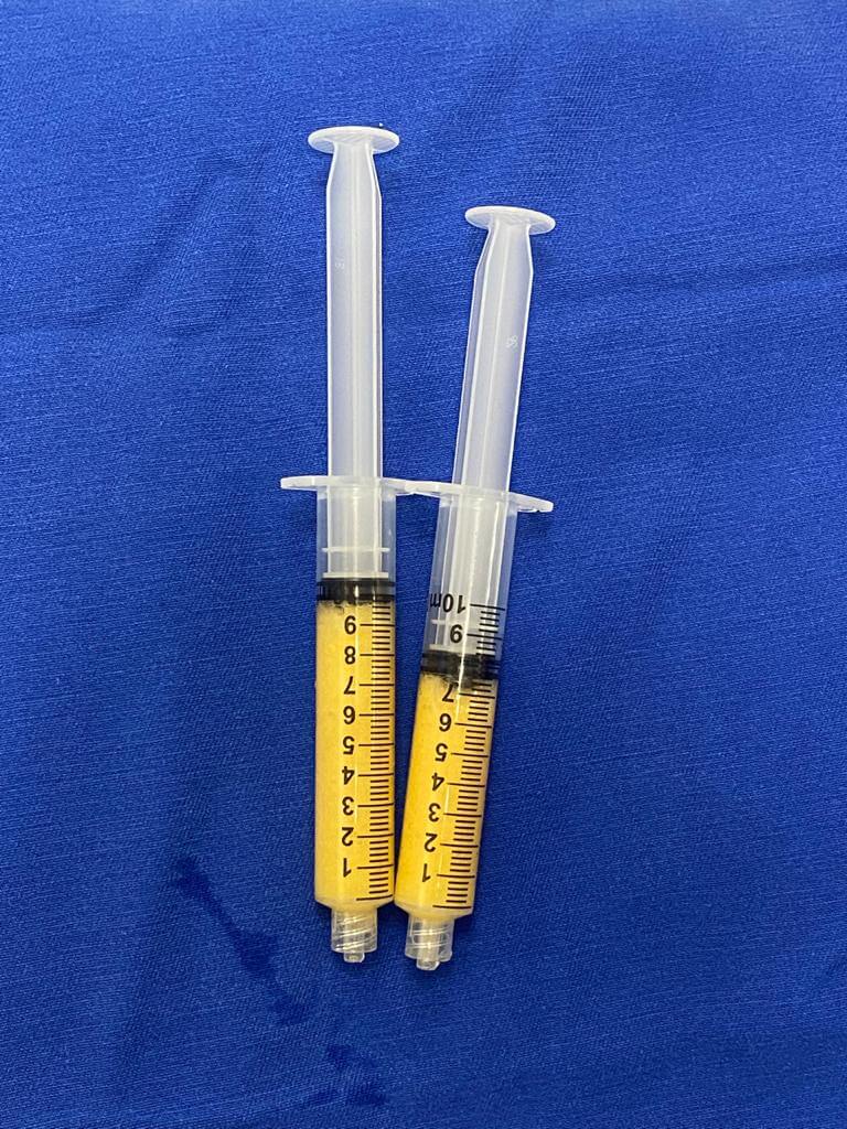 Lipogems - Dr. Fabiano Kupczik
