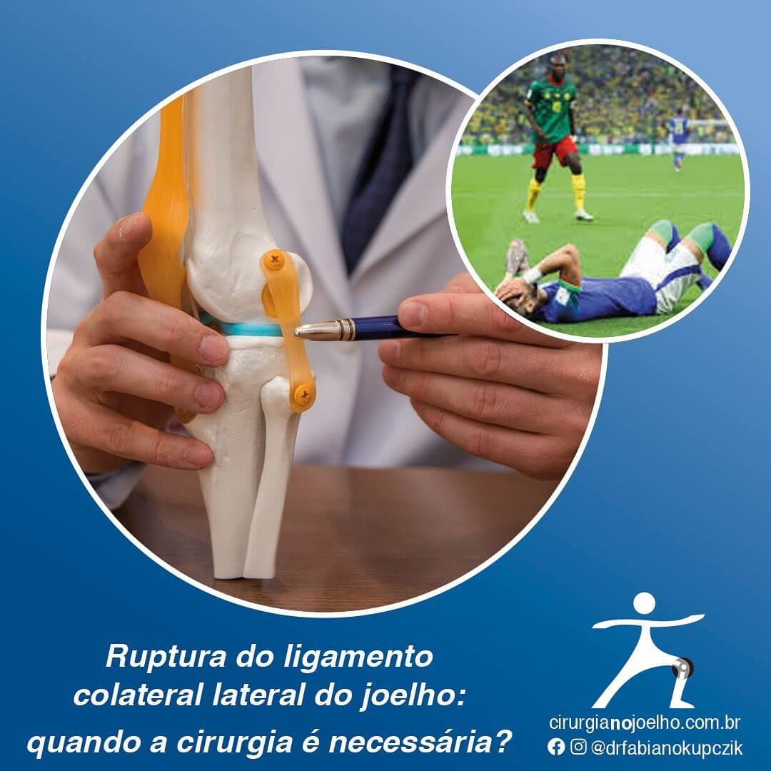 ruptura do ligamento colateral lateral do joelho quando a cirurgia é